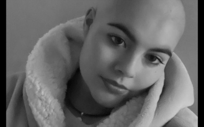 Teenager thought pain in her side was a muscle strain – but it was cancer