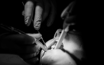Research” suggests that bad dental health may increase the risk of dementia.