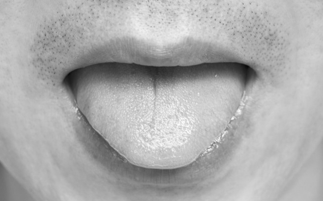What color is your tongue? What's healthy, what's not?